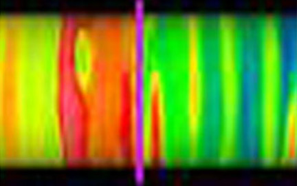 thermographie-infrarouge
